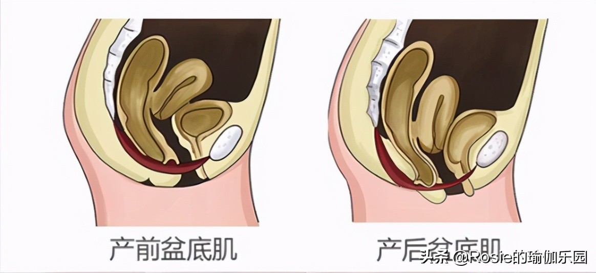 眼馋陈卓璇巴掌腰，竟靠束腰勒小腰？做对一个动作一周瘦出小蛮腰
