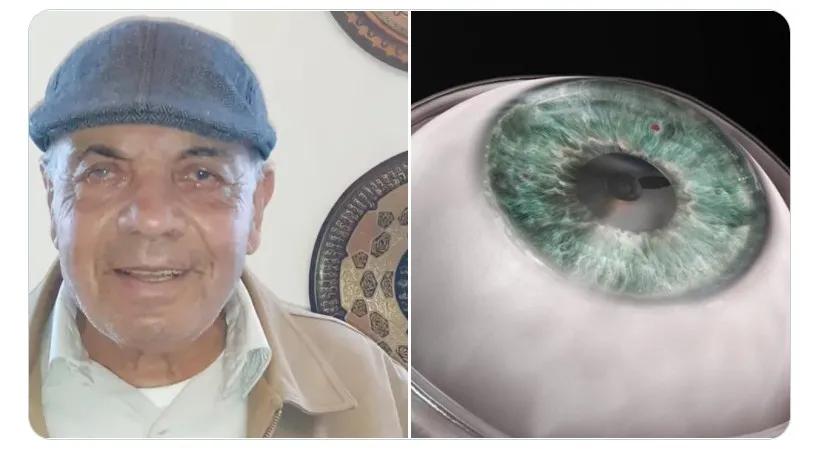 世界第一例眼角膜移植手术,我国首例眼角膜移植手术