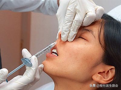 玻尿酸填充鼻梁一次会变宽吗,玻尿酸隆鼻会让鼻梁变宽吗