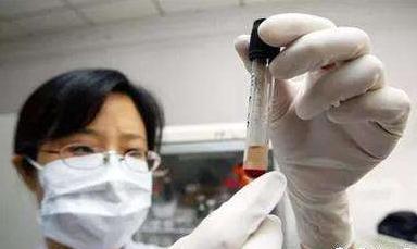 怀孕8周到12周之间还需要做检查么,怀孕12周之后多久产检一次