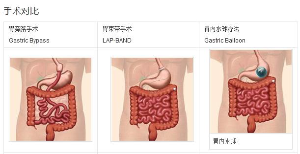 涓冪鍑忚偉鑽笉浼よ偩,涓冪鍑忚偉鑽笉浼よ偩鐨勬湁鍝簺