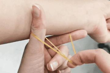 光子和光子嫩肤有什么区别,光子嫩肤和超光子有什么区别