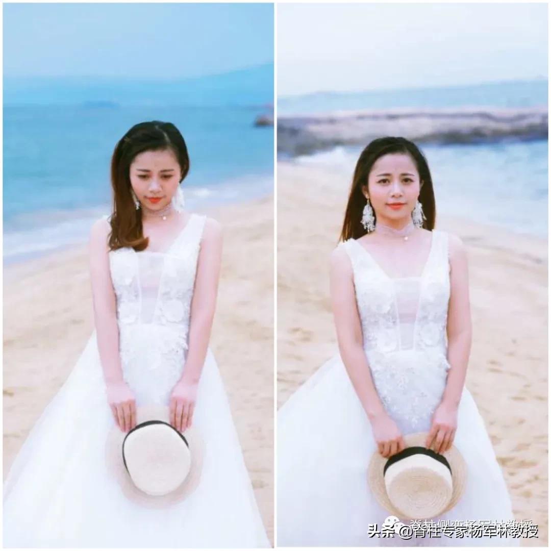 女高中生脊柱侧弯治疗视频,15岁女生脊柱侧弯能自愈吗