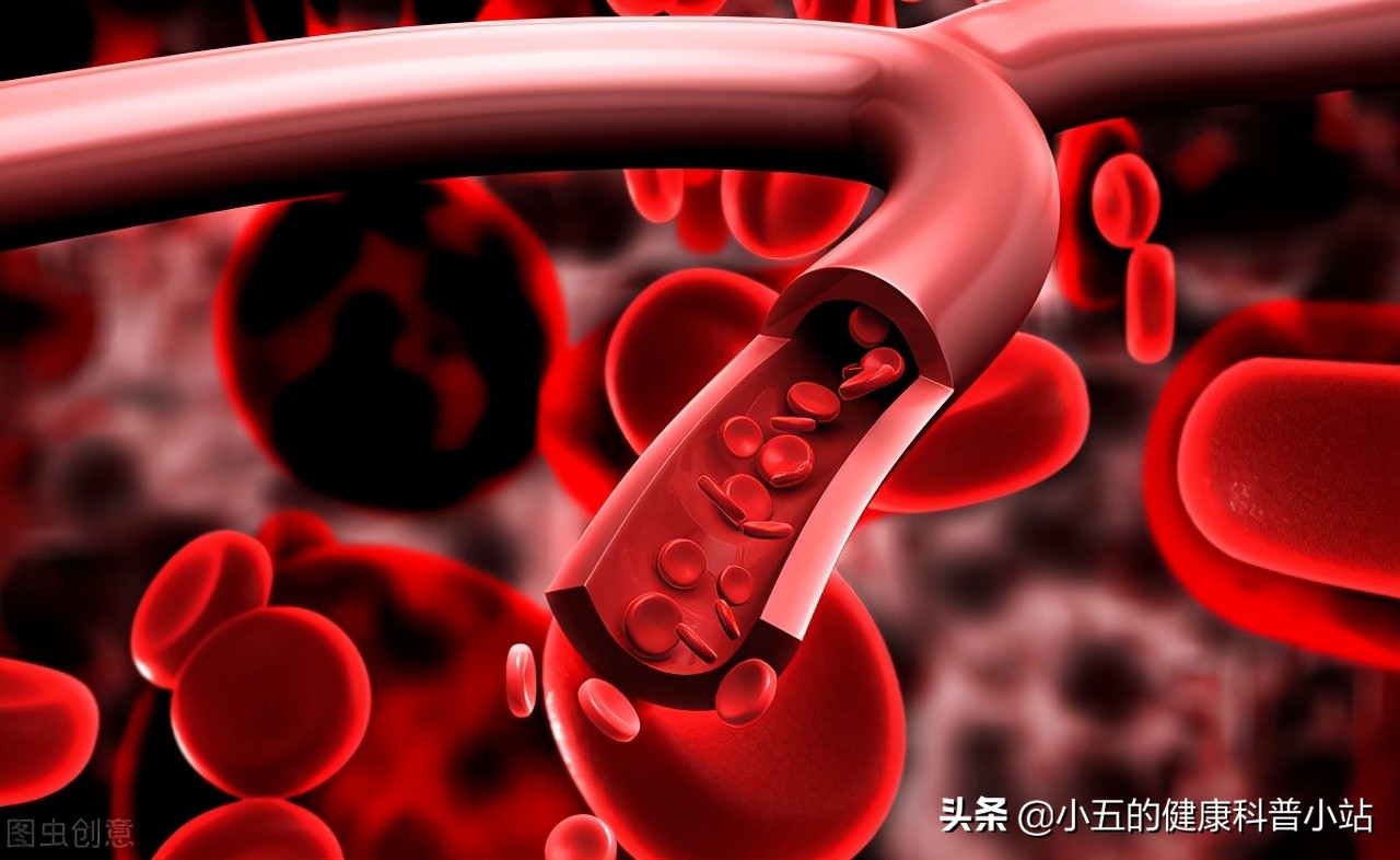 丹参滴丸治心血管病吗,丹参滴丸治心血管堵塞吗