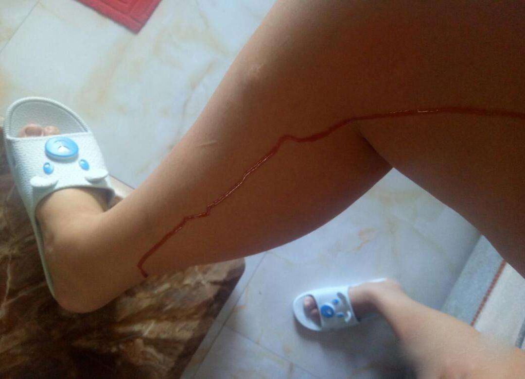 一旦孕期见红,真的代表胎儿即将不保吗?专家表示:要区分情况