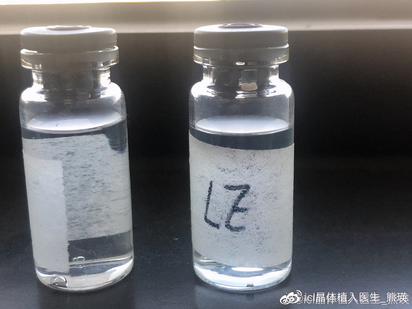 icl手术的后遗症,icl手术失败的案例