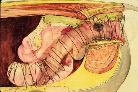 母猪人工助产最新视频,母猪助产钳的使用视频