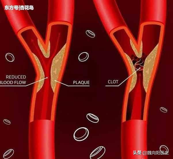 降血压过快有什么危险,血压高的人如何降血压
