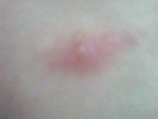 家有宠物跳蚤怎么根除,养宠物如何除跳蚤