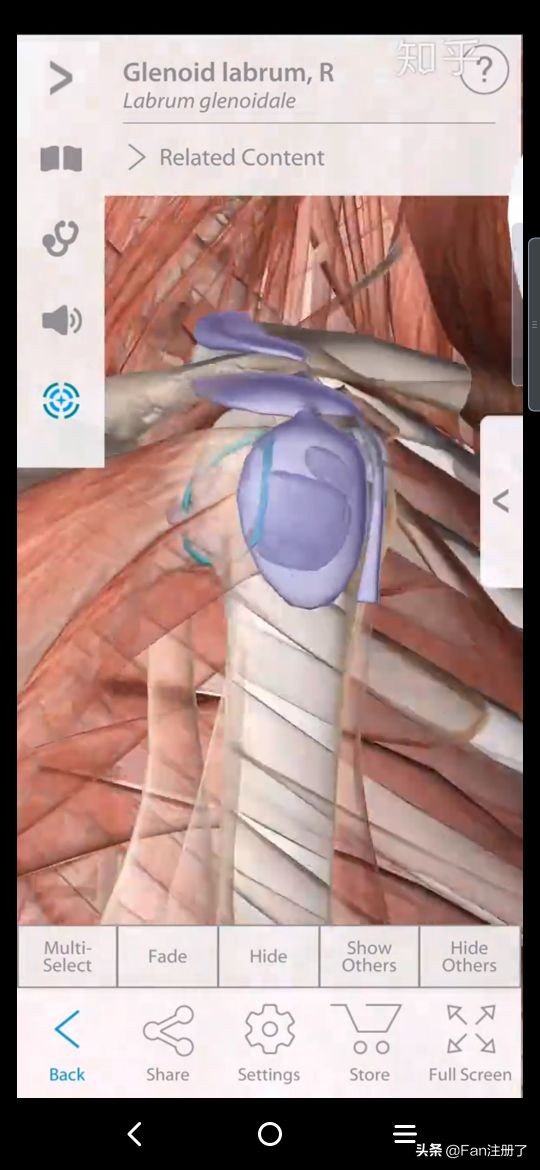 肩痛肩袖损伤针刀治疗,肩痛肩关节活动受限用什么药