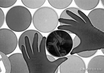 男性有妇科病是什么原因,容易被男性忽视的八种疾病