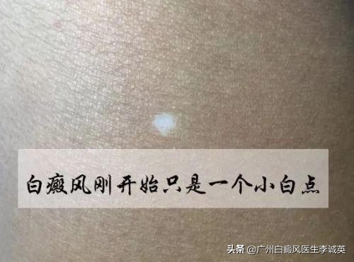 国庆旅游人挤人黄山图片,黄山旅游人挤人视频