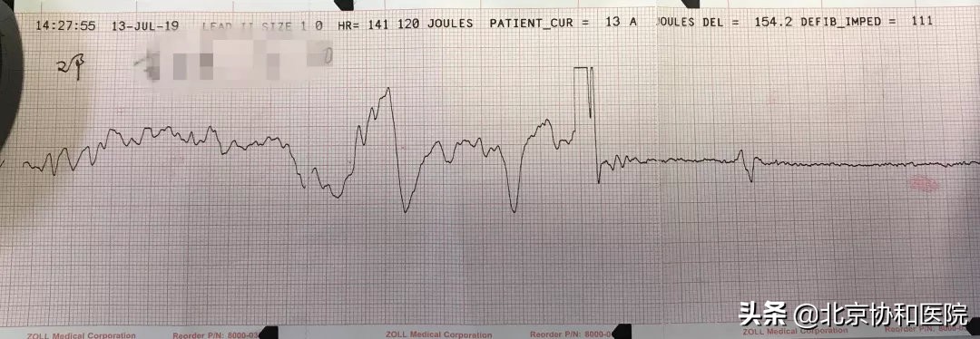 荆州95后护士救人,90后护士路边救人