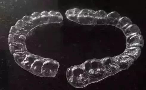 雅悦齿科矫正牙齿好不,上海牙齿矫正保持器要戴多久