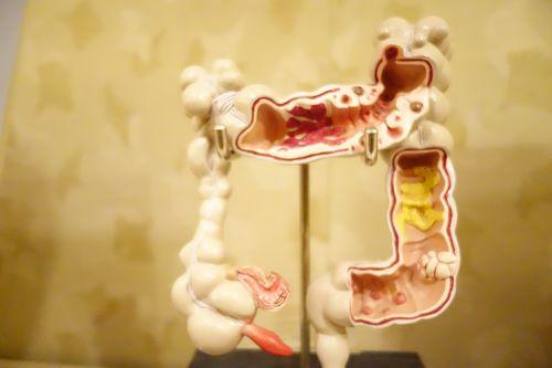 大肠息肉摘除后是否会再长?肠息肉切除后多长时间复查比较合适?