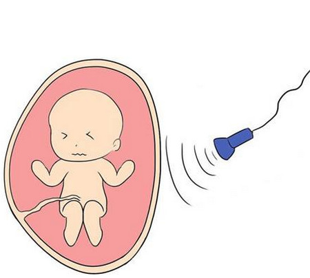 出生缺陷现状如何,远离出生缺陷