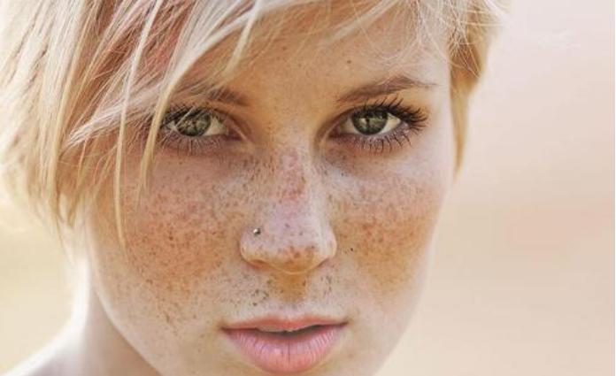 专家快速祛斑妙招推荐视频,皮肤科医生美白祛斑妙招