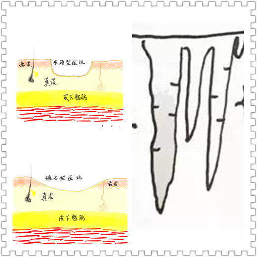 都挺好评分高还是低,都挺好后期