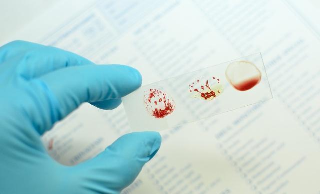 血型概念和abo血型分析,为什么自己的血型有ab型的