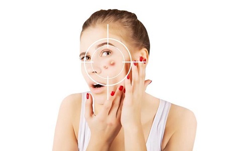 祛痘排行榜10强品牌推荐,祛痘知名品牌排行榜前十名