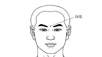 神经调控技术治疗抑郁症,针清知识普及