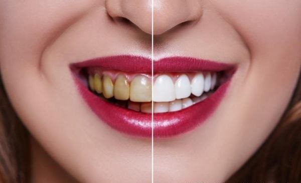 智齿蛀牙痛有什么有效方法止痛,智齿旁边牙松动蛀牙如何处理