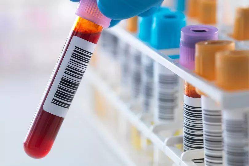 白细胞参考意义,白细胞显示加减号啥意思