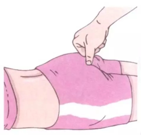 艾灸子宫穴后容易怀孕吗,艾灸暖宫有助于受孕