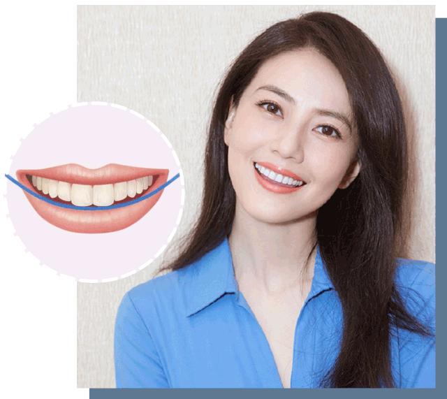 怎么练出angelababy微笑唇,angelababy演技微笑唇