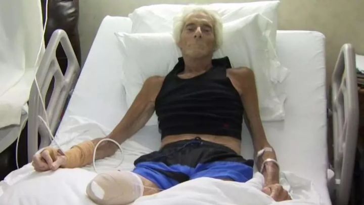 食肉菌感染有多可怕,食肉菌是不是罕见病菌