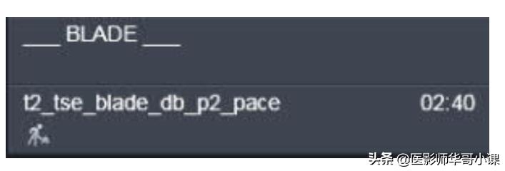 磁共振心脏扫描标准切面,心脏mri扫描定位