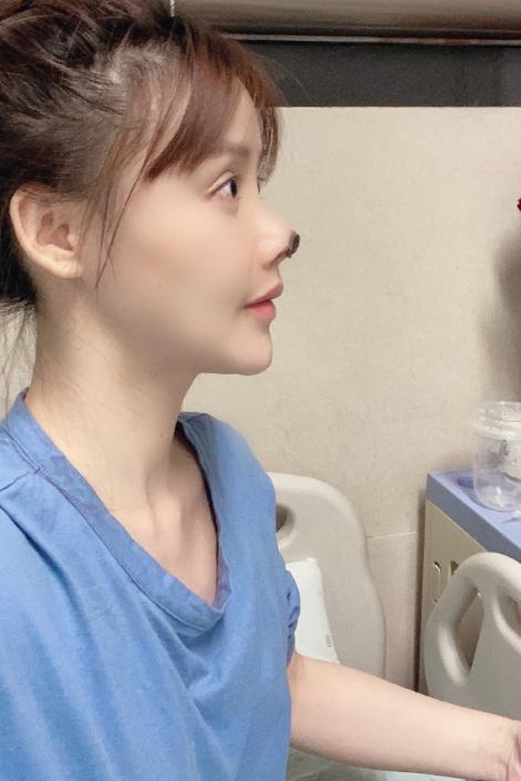 95后整容女演员,高溜整容失败案例