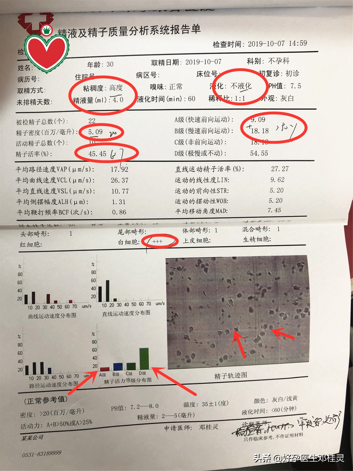 一张精液报告单引发的男人健康指南——除了吃药,多喝水不是玩笑