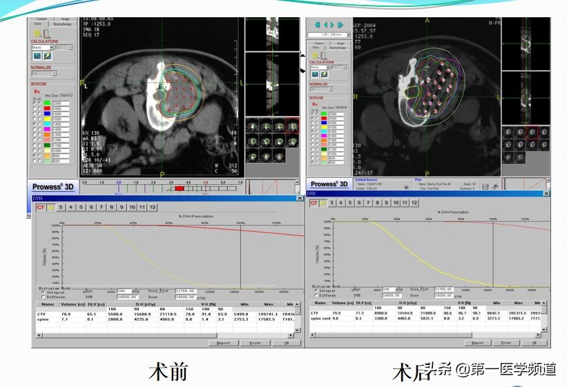 「医影传声」上海交通大学医学院附属瑞金医院卢湾分院放射科主任