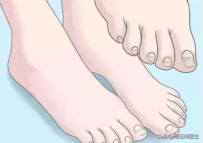 灰指甲和脚气哪个传染性强,疥疮和灰指甲哪个传染性强