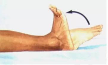 踝关节扭伤包扎,踝关节扭伤热敷