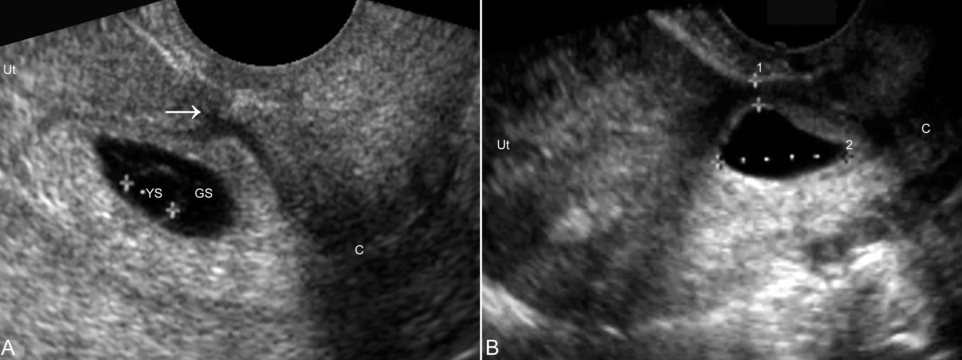 超声全腹检查视频教程,做超声全过程看肚子