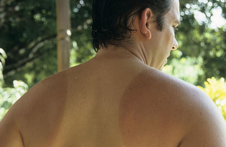 皮肤黑怎么变白立马见效,皮肤暗黑怎么变白小妙招