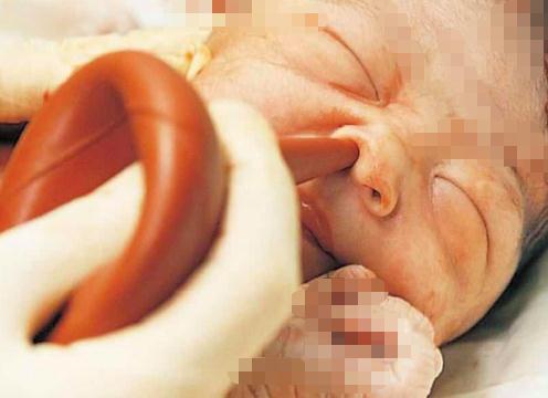 宝宝顺产出生的过程,剖腹产的小孩比顺产的小孩胆小吗