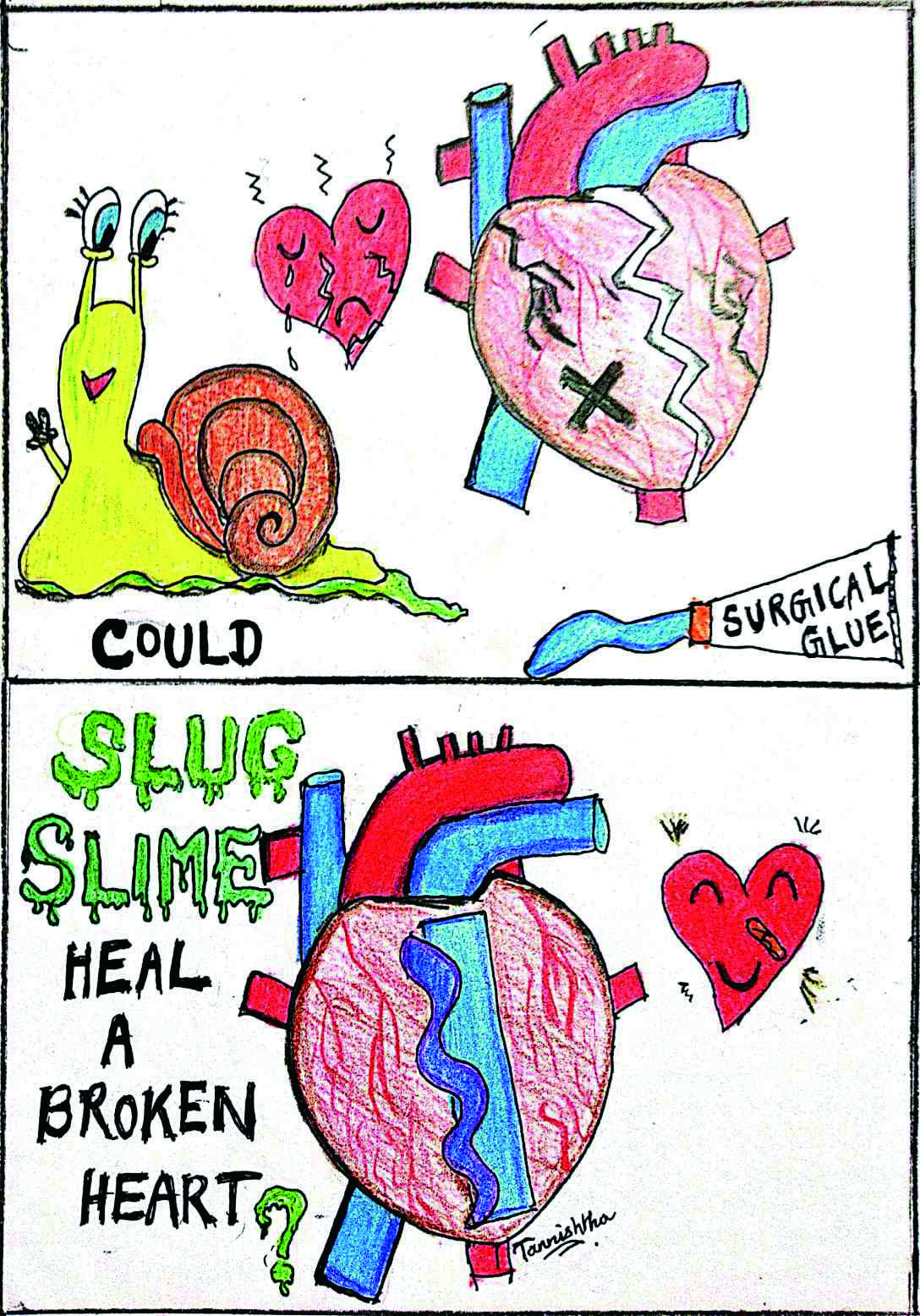 手术后免拆线用温水洗线会融化吗,医用胶水缝合伤口几天会愈合