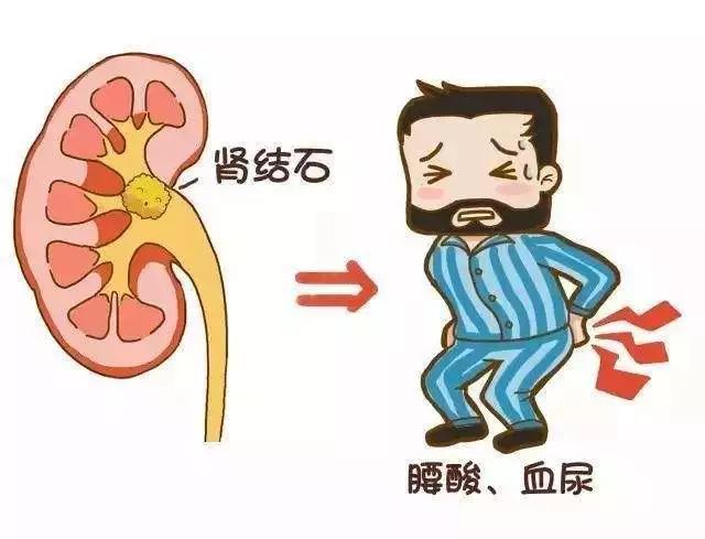 日照市人民医院微课堂——发现血尿怎么办？