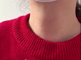 脱发为什么检查甲状腺功能,严重脱发是不是得了甲亢