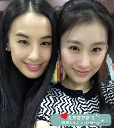 鼻子宽大眼距过近,鼻子宽度大于眼间距原因