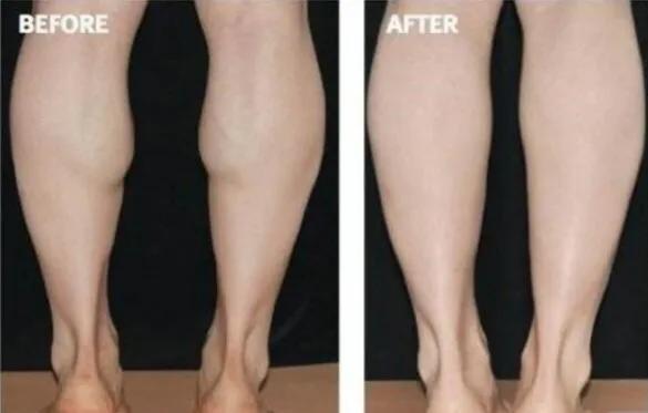 38岁坚持跑步13年,38岁张钧甯坚持跑步13年