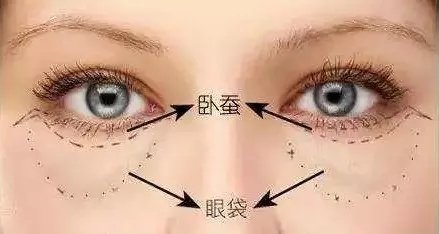 滤镜还是拯救不了眼袋,适合有眼袋的滤镜