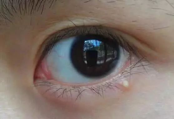 鍚嶉棬娉戒匠315鐪肩僵鏈夋晥鏋滃悧,鍚嶉棬娉戒匠315鐪熷亣瀵规瘮