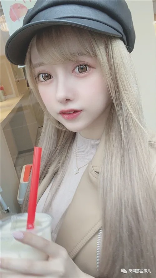 20岁漂亮女子花6万整容鼻子失败,19岁少女花百万整容