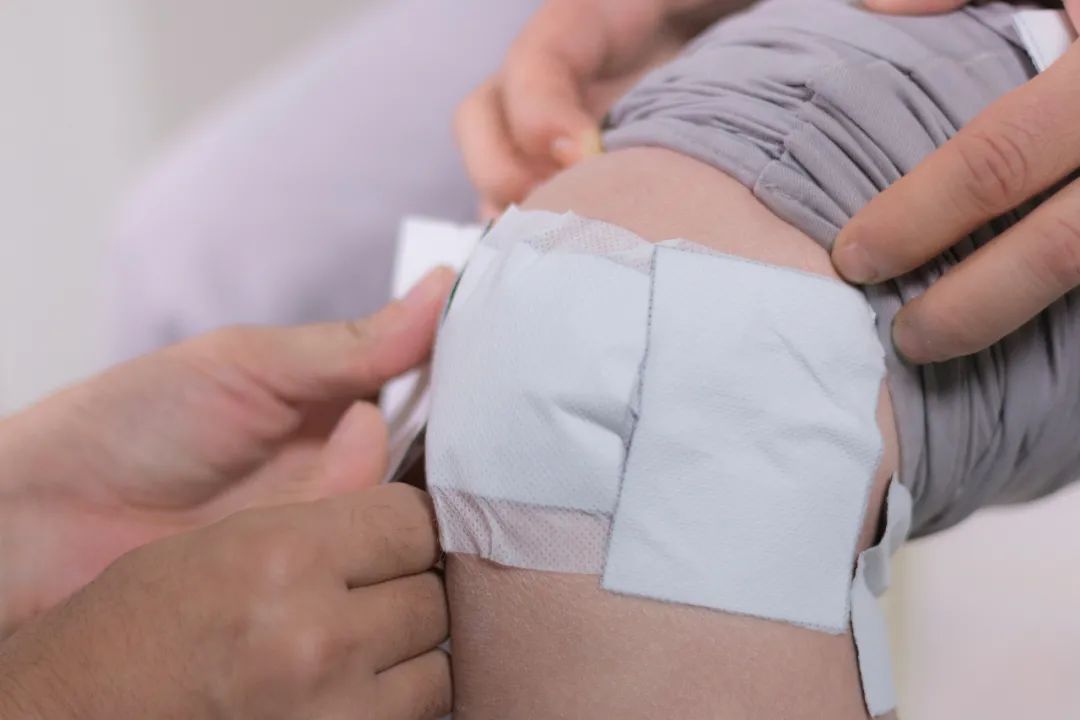 三九贴是什么,贴三九贴的注意事项有哪些