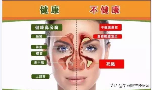 鼻窦炎危害有哪些,鼻窦炎有哪些危害