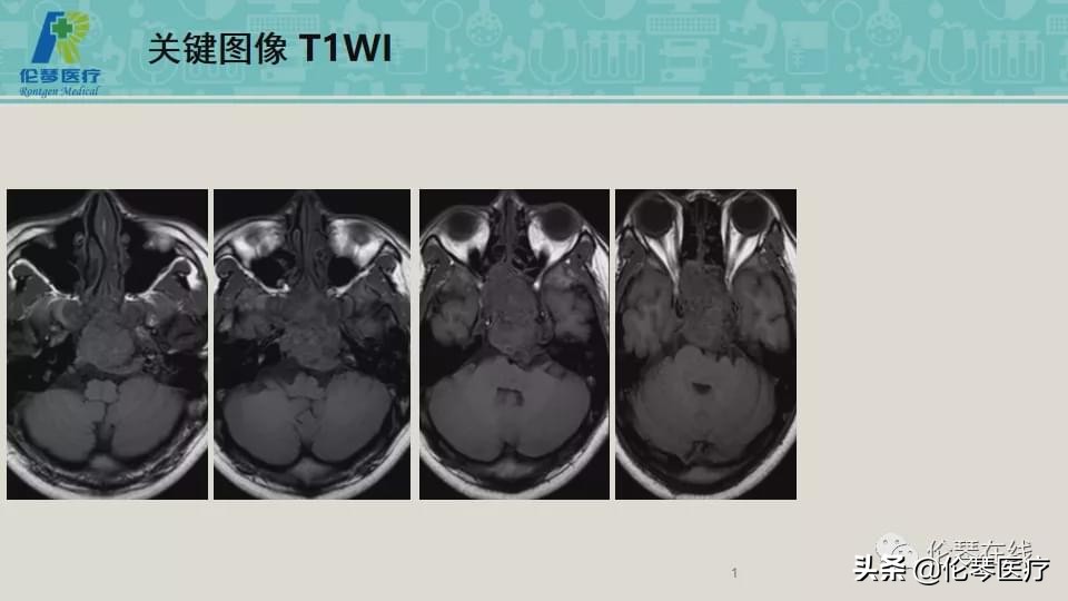上海教授詹松华,上海曙光医院詹松华简介